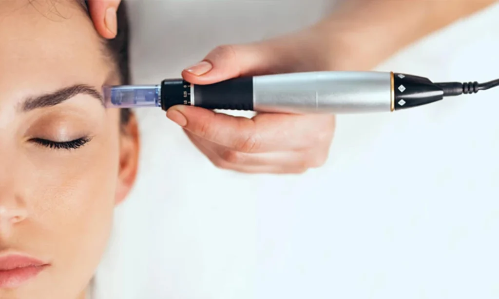 Dermapen Tedavisi Sonrası Dikkat Edilmesi Gerekenler - İstanbul Dermatolog