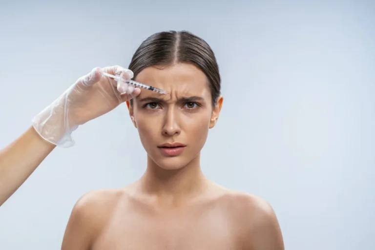 Kaş Arası Dolgu Uygulaması - İstanbul Dermatolog