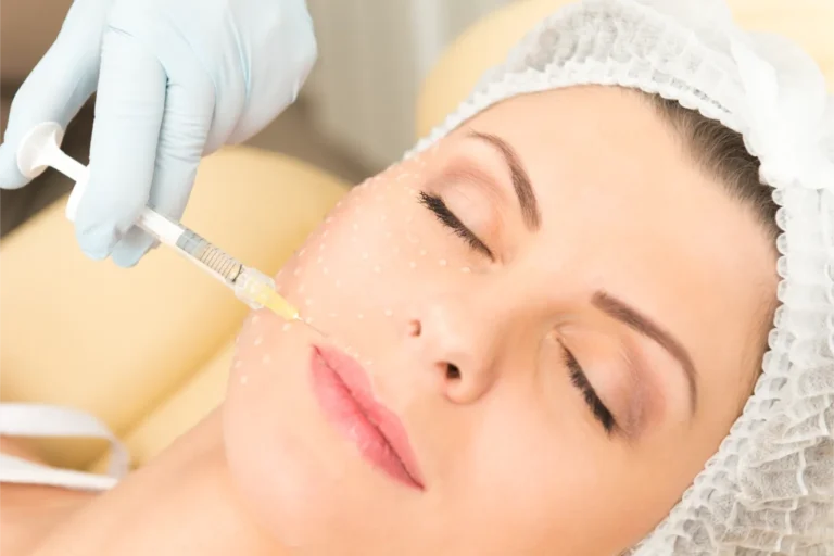 Kollajen Dolgu Tedavisi - İstanbul Dermatolog