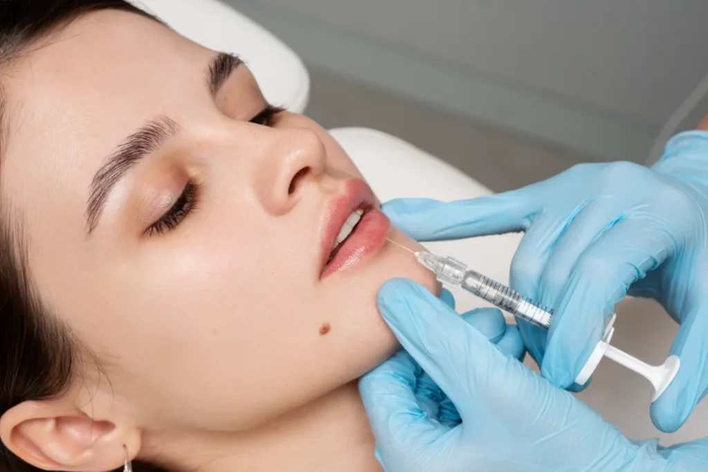 Russian Lips Dudak Dolgusu Nedir? - İstanbul Dermatolog