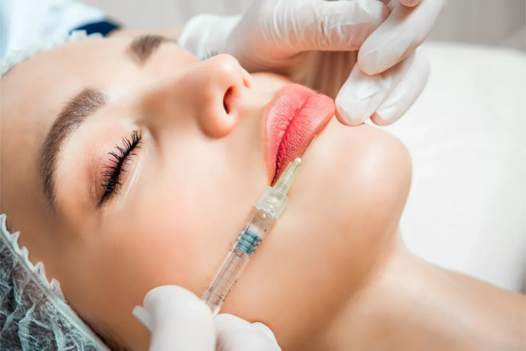 Russian Lips Dudak Dolgusu Uygulama Süreci 