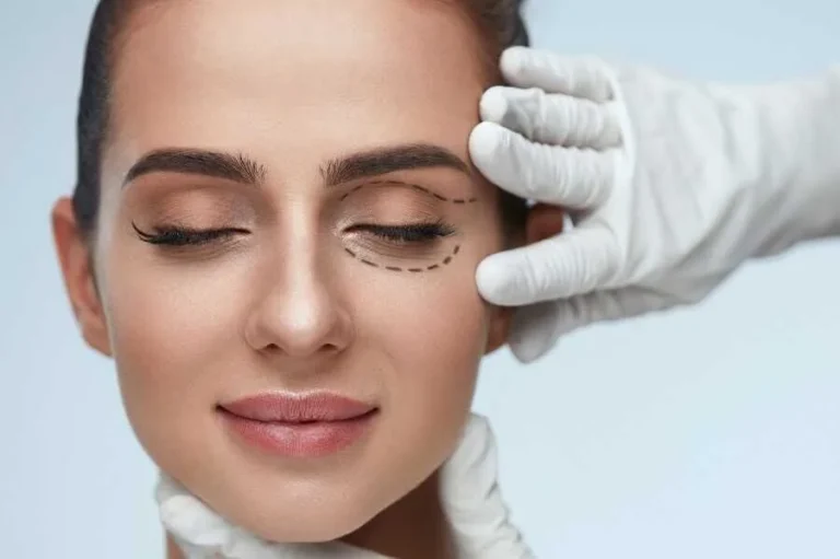 Göz Kapağı Estetiği - İstanbul Dermatolog